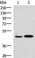 Western blot analysis of Human fetal liver tissue and Human liver tissue lysates using BHMT2 Polyclonal Antibody at dilution of 1:800