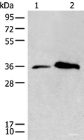Western blot analysis of Human lymph gland tissue and Jurkat cell lysates using CD86 Polyclonal Antibody at dilution of 1:450