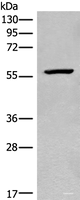 Western blot analysis of Mouse heart tissue lysate using CDADC1 Polyclonal Antibody at dilution of 1:450