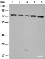 Western blot analysis of Hela and A431 cell Mouse brain tissue HT-29 and Jurkat cell lysates using GARS Polyclonal Antibody at dilution of 1:540