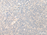 Immunohistochemistry of paraffin-embedded Human tonsil tissue using RADIL Polyclonal Antibody at dilution of 1:40 (×200)