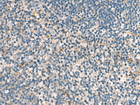 Immunohistochemistry of paraffin-embedded Human tonsil tissue using ACTC1 Polyclonal Antibody at dilution of 1:55 (×200)