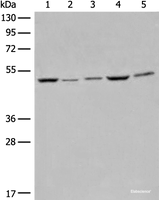 Western blot analysis of Raji Hela A549 HEPG2 and 231 cell lysates using EIF4A3 Polyclonal Antibody at dilution of 1:500