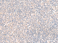 Immunohistochemistry of paraffin-embedded Human tonsil tissue using CCDC47 Polyclonal Antibody at dilution of 1:25 (×200)
