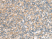 Immunohistochemistry of paraffin-embedded Human tonsil tissue using KIF2C Polyclonal Antibody at dilution of 1:70 (×200)