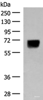 Western blot analysis of Human thyroid tissue lysate using DGLUCY Polyclonal Antibody at dilution of 1:250