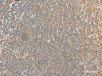 Immunohistochemistry of paraffin-embedded Human tonsil tissue using DGLUCY Polyclonal Antibody at dilution of 1:40 (×200)