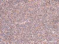 Immunohistochemistry of paraffin-embedded Human tonsil tissue using MRPS24 Polyclonal Antibody at dilution of 1:90 (×200)