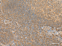 Immunohistochemistry of paraffin-embedded Human tonsil tissue using RAC3 Polyclonal Antibody at dilution of 1:45 (×200)