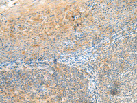 Immunohistochemistry of paraffin-embedded Human tonsil tissue using CLEC3B Polyclonal Antibody at dilution of 1:90 (×200)