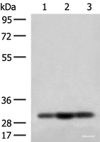 Western blot analysis of HepG2 Jurkat and 231 cell lysates using MRPS18B Polyclonal Antibody at dilution of 1:200