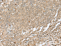 Immunohistochemistry of paraffin-embedded Human tonsil tissue using SNAPC1 Polyclonal Antibody at dilution of 1:40 (×200)