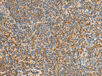 Immunohistochemistry of paraffin-embedded Human tonsil tissue using STK32C Polyclonal Antibody at dilution of 1:40 (×200)