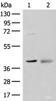 Western blot analysis of Mouse kidney tissue and Human fetal brain tissue lysates using ADH5 Polyclonal Antibody at dilution of 1:500