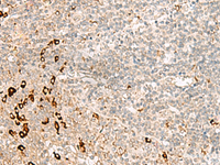 Immunohistochemistry of paraffin-embedded Human tonsil tissue using RMND5A Polyclonal Antibody at dilution of 1:50 (×200)