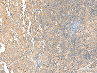 Immunohistochemistry of paraffin-embedded Human tonsil tissue using NARS Polyclonal Antibody at dilution of 1:55 (×200)