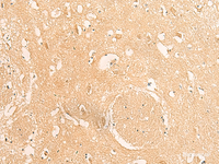 Immunohistochemistry of paraffin-embedded Human brain tissue using IFITM2 Polyclonal Antibody at dilution of 1:25 (×200)