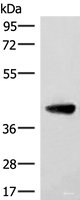 Western blot analysis of Human cerebella tissue lysate using ST8SIA4 Polyclonal Antibody at dilution of 1:350