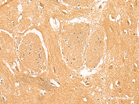 Immunohistochemistry of paraffin-embedded Human brain tissue using PPP1R1A Polyclonal Antibody at dilution of 1:50 (×200)