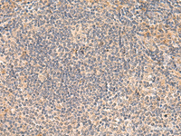 Immunohistochemistry of paraffin-embedded Human tonsil tissue using FUNDC2 Polyclonal Antibody at dilution of 1:50 (×200)