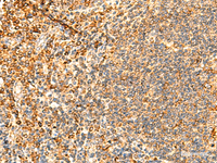 Immunohistochemistry of paraffin-embedded Human tonsil tissue using PPM1B Polyclonal Antibody at dilution of 1:50 (×200)