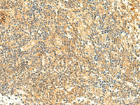 Immunohistochemistry of paraffin-embedded Human tonsil tissue using ARL4D Polyclonal Antibody at dilution of 1:50 (×200)