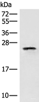 Western blot analysis of HT29 cell lysate using EIF3K Polyclonal Antibody at dilution of 1:400