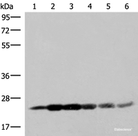 Western blot analysis of 293T cell lysates using GSTK1 Polyclonal Antibody at dilution of 1:250