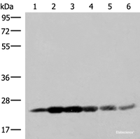 Western blot analysis of 293T cell lysates using GSTK1 Polyclonal Antibody at dilution of 1:250