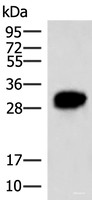 Western blot analysis of HepG2 cell lysate using HCCS Polyclonal Antibody at dilution of 1:4000