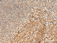 Immunohistochemistry of paraffin-embedded Human tonsil tissue using GALNT12 Polyclonal Antibody at dilution of 1:60 (×200)