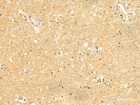 Immunohistochemistry of paraffin-embedded Human brain tissue using KIAA0513 Polyclonal Antibody at dilution of 1:50 (×200)