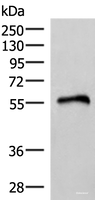 Western blot analysis of Human heart tissue lysate using RETREG1 Polyclonal Antibody at dilution of 1:400