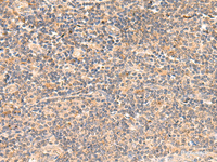 Immunohistochemistry of paraffin-embedded Human tonsil tissue using TEAD3 Polyclonal Antibody at dilution of 1:50 (×200)