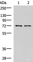 Western blot analysis of Mouse liver tissue and Jurkat cell lysates using MKS1 Polyclonal Antibody at dilution of 1:700