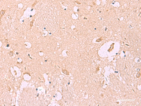 Immunohistochemistry of paraffin-embedded Human brain tissue using MKS1 Polyclonal Antibody at dilution of 1:50 (×200)