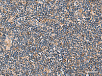 Immunohistochemistry of paraffin-embedded Human tonsil tissue using PDHA1 Polyclonal Antibody at dilution of 1:50 (×200)