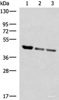 Western blot analysis of Human fetal liver tissue PC-3 and A172 cell lysates using SCCPDH Polyclonal Antibody at dilution of 1:1000