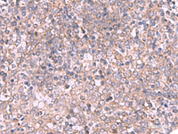 Immunohistochemistry of paraffin-embedded Human tonsil tissue using ECSIT Polyclonal Antibody at dilution of 1:70 (×200)