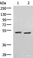 Western blot analysis of Human cerebella tissue K562 cell lysates using RRP8 Polyclonal Antibody at dilution of 1:1000