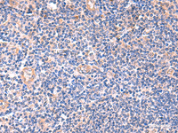 Immunohistochemistry of paraffin-embedded Human tonsil tissue using ZNF256 Polyclonal Antibody at dilution of 1:120 (×200)