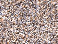 Immunohistochemistry of paraffin-embedded Human tonsil tissue using GPKOW Polyclonal Antibody at dilution of 1:140 (×200)