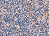 Immunohistochemistry of paraffin-embedded Human tonsil tissue using MYOT Polyclonal Antibody at dilution of 1:65 (×200)