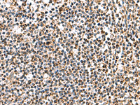 Immunohistochemistry of paraffin-embedded Human tonsil tissue using AP1S3 Polyclonal Antibody at dilution of 1:70 (×200)