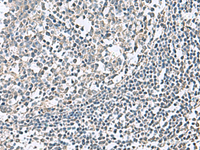 Immunohistochemistry of paraffin-embedded Human tonsil tissue using NPHP1 Polyclonal Antibody at dilution of 1:75 (×200)