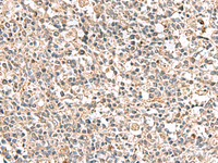 Immunohistochemistry of paraffin-embedded Human tonsil tissue using PTPRS Polyclonal Antibody at dilution of 1:110 (×200)