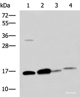 Western blot analysis of Human sigmoid tissue Mouse large intestine tissue Mouse small intestines tissue Mouse Pancreas tissue lysates using ZG16 Polyclonal Antibody at dilution of 1:800