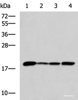 Western blot analysis of K562 Jurkat HepG2 cell Human fetal intestines tissue lysates using AK6 Polyclonal Antibody at dilution of 1:800
