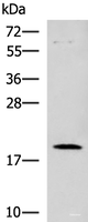 Western blot analysis of Human heart tissue lysate using DNPH1 Polyclonal Antibody at dilution of 1:800