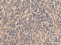 Immunohistochemistry of paraffin-embedded Human tonsil tissue using PLEKHF2 Polyclonal Antibody at dilution of 1:90 (×200)